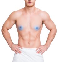 Depilación Láser Areola. 6 SESIONES