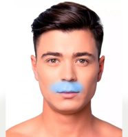 Depilación Láser Bigote. 6 SESIONES