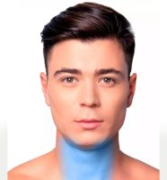 Depilación Láser Cuello Anterior. 6 SESIONES