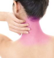 Depilación Láser Cuello Posterior. 6 SESIONES