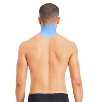 Depilación Láser Cuello Posterior. 6 SESIONES