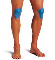 Depilación Láser Rodilla. 6 SESIONES