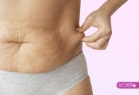 ANTI CELULITIS - LIPOMAX Corporal - 6 SESIONES
