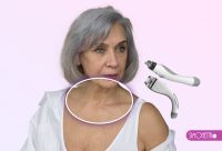 VELASHAPE Facial - Rejuvenecedor Cuello. 6 SESIONES