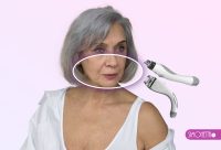VELASHAPE Facial - Rejuvenecedor Frontal Inferior. 6 SESIONES